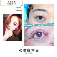 星璨整形|沪上网红整形
