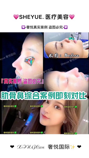 上海眼综合修复整形