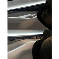 凹陷修复