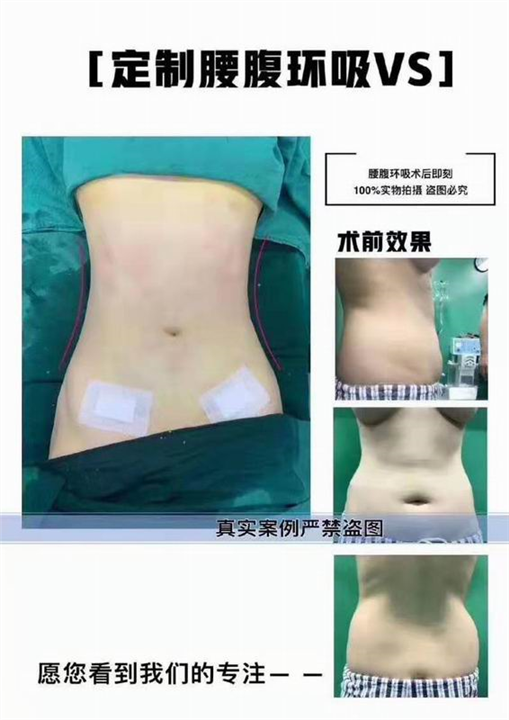 上海美之星3