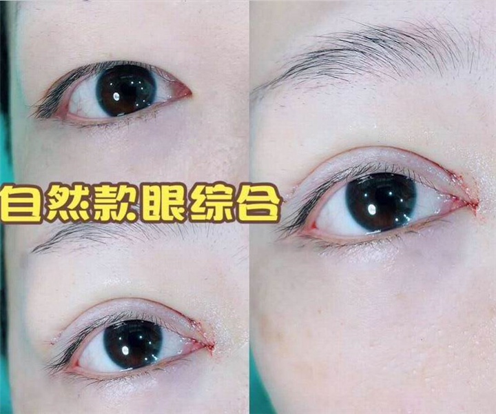 上海美星11