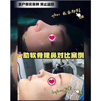 上海美星70