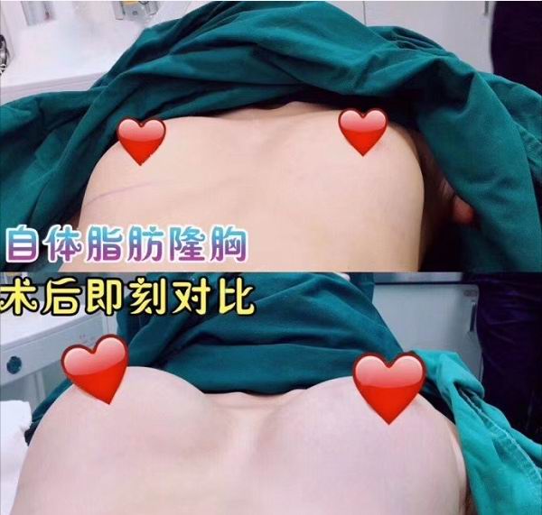 上海美之星1