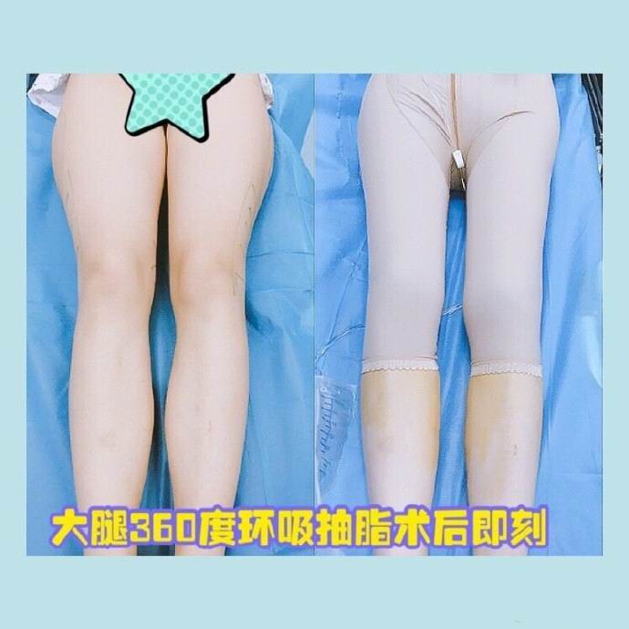 上海美星