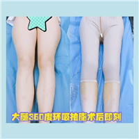 上海美星