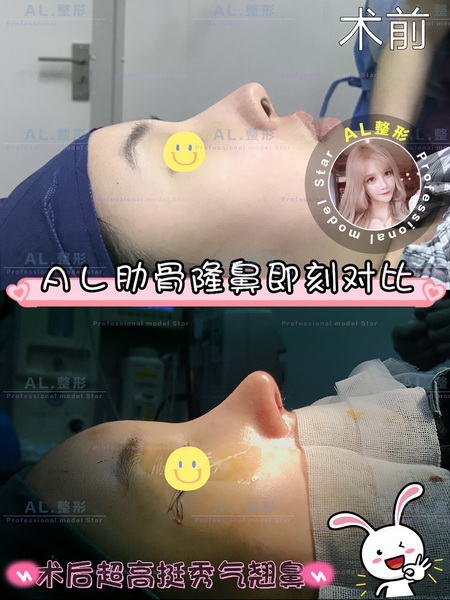 AL国际整形