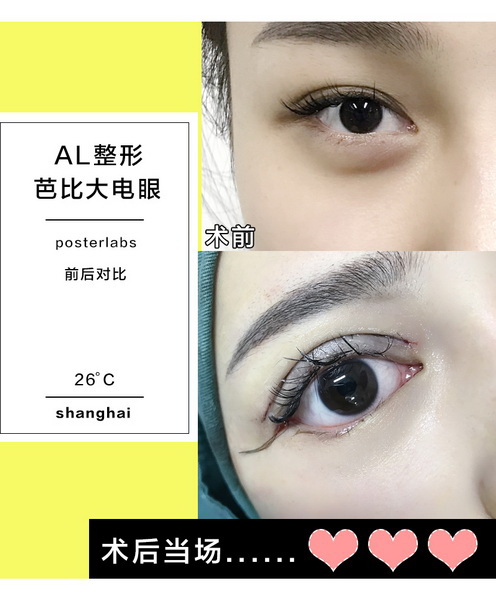 上海AL整形