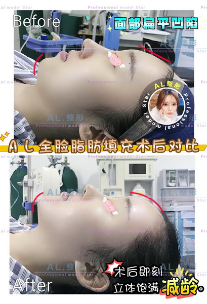 上海AL整形