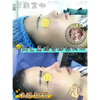 上海AL整形