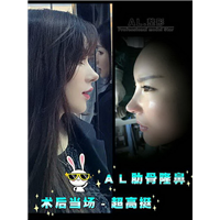 上海AL整形