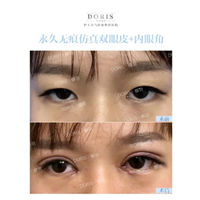 内眼角怎么开才会有灵气