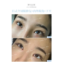 开外眼角的黄金搭档一眼脸下至