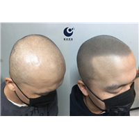 洛阳纹发