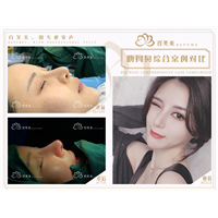 西安肋骨鼻整形医生 