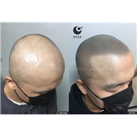 石家庄纹发|机构，价格，电话