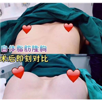 上海网红明星整形