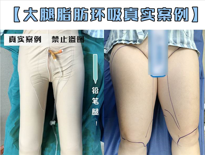 上海正规人气医美整形