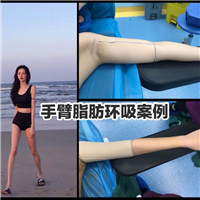 上海专业网红脸打造