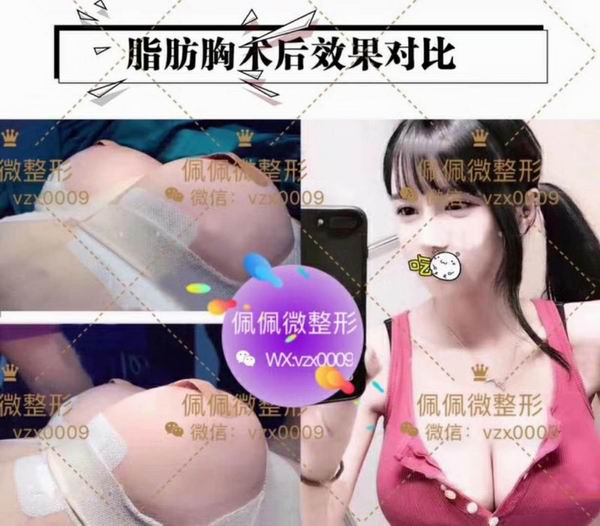 上海哪家网红整形专业