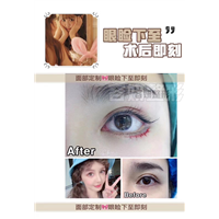 上海眼综合哪家专业 