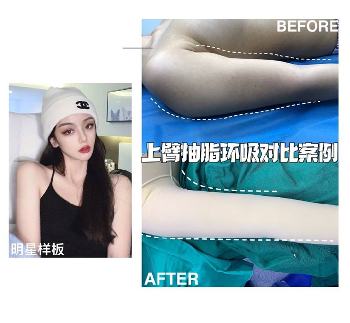 上海专业网红脸打造