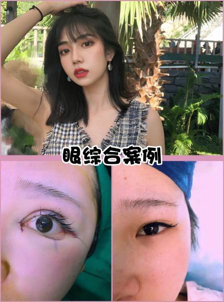 上海专业整形修复