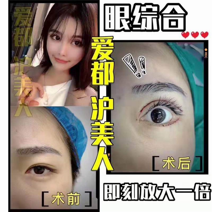上海专业整形修复