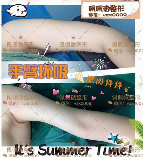 上海网红整形|上海网红修复整形