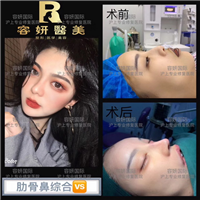 上海高级脸打造整形 