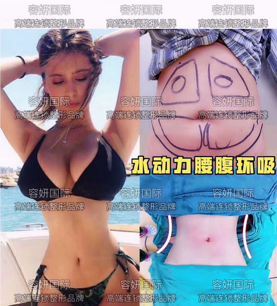 上海眼综合整形 