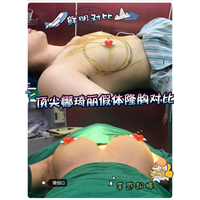 上海网红明星整形