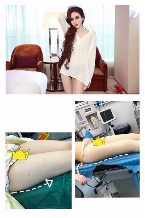 上海正规人气医美整形