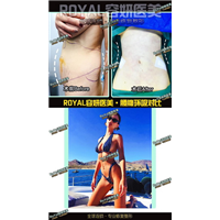 上海眼综合整形 
