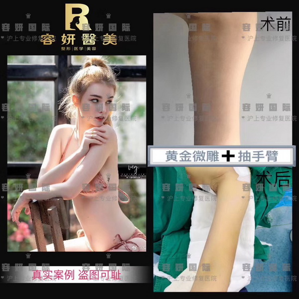上海高级脸打造整形