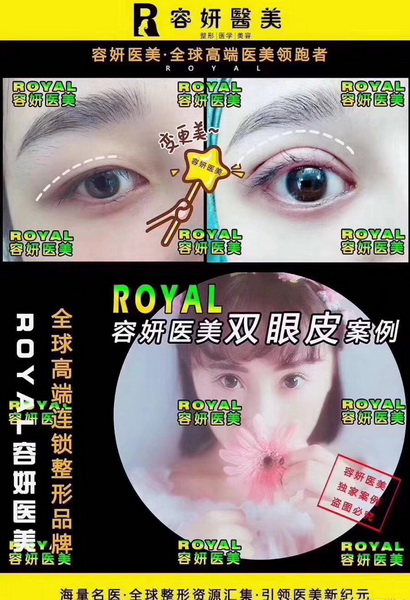 上海鼻综合整形 
