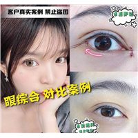 上海人气网红整形