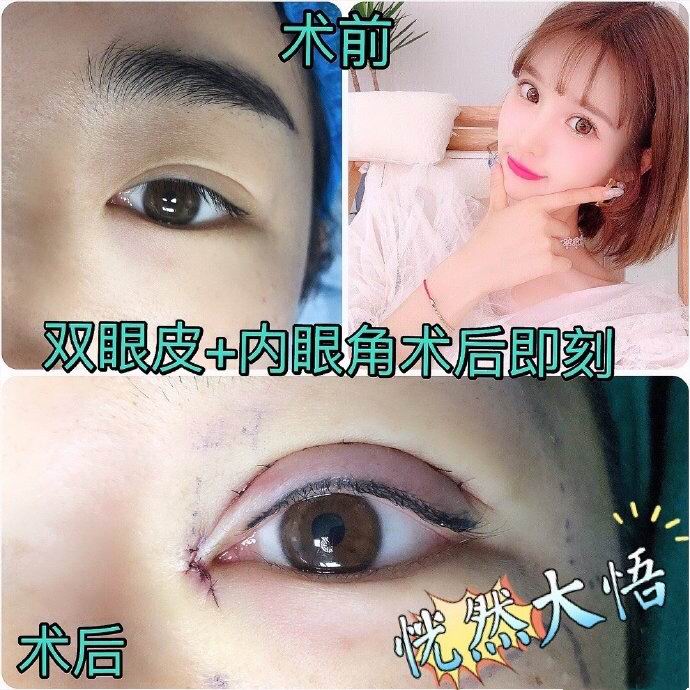 上海专业整形修复
