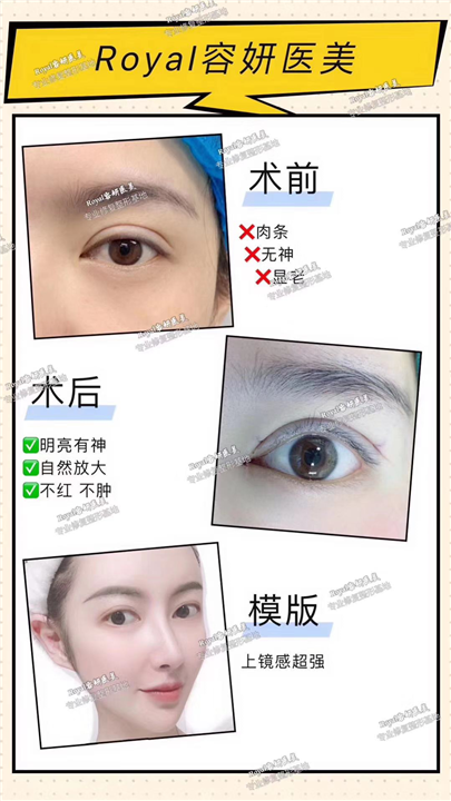 上海眼综合哪家专业 