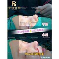 上海眼综合整形 