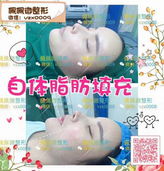 上海网红修复整形|上海网红整形哪家好