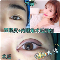 上海专业整形修复