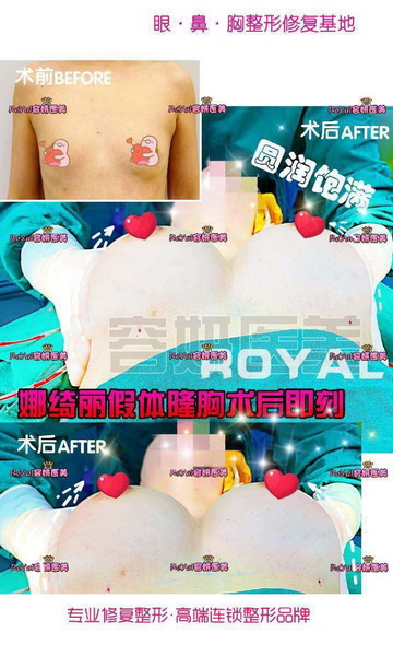 上海网红整形 