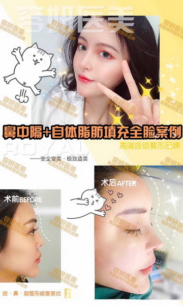 上海高级脸打造整形 