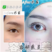上海眼综合哪家专业 