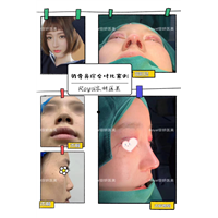 上海眼综合整形哪家好 