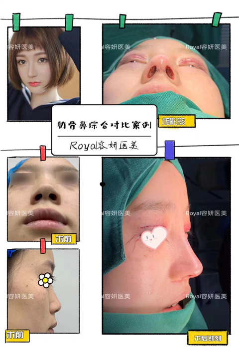上海眼综合整形哪家好 