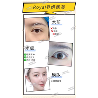 上海眼综合哪家专业 