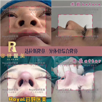 上海眼综合整形 