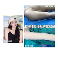 上海正规人气医美整形