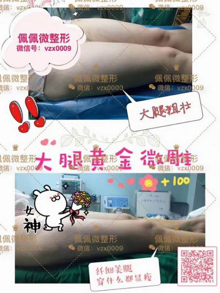 上海**专业的修复整形
